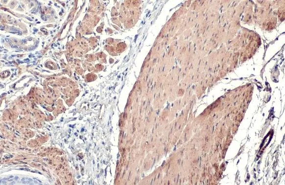 alpha Smooth Muscle Actin antibody [HL1419] detects alpha Smooth Muscle Actin protein at cytoplasm by immunohistochemical analysis. Sample: Paraffin-embedded mouse smooth muscle. alpha Smooth Muscle Actin stained by alpha Smooth Muscle Actin antibody [HL1419] (GTX636885) diluted at 1:100. Antigen Retrieval: Citrate buffer, pH 6.0, 15 min