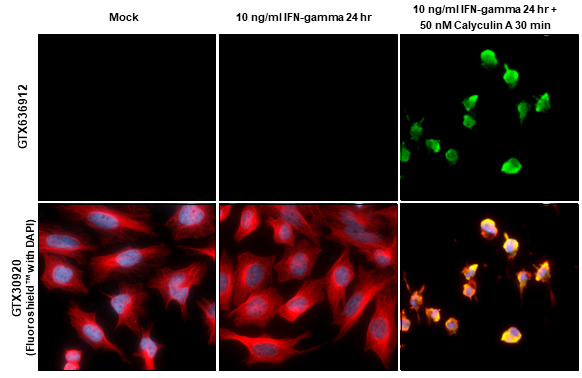 PKR (phospho Thr446) antibody [HL1439] detects PKR (phospho Thr446) protein at cytoplasm by immunofluorescent analysis. Sample: Mock and treated HeLa cells were fixed in 4% paraformaldehyde at RT for 15 min. Green: PKR (phospho Thr446) stained by PKR (phospho Thr446) antibody [HL1439] (GTX636912) diluted at 1:500. Red: alpha Tubulin, a cytoskeleton marker, stained by alpha Tubulin antibody [GT114] (GTX628802) diluted at 1:1000. Blue: Fluoroshield with DAPI (GTX30920). Scale bar= 10μm.