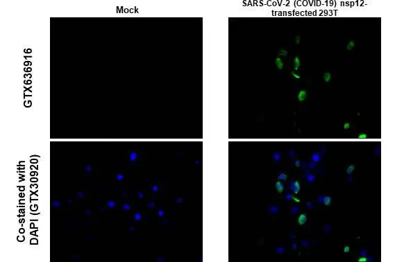 SARS-CoV-2 nsp12 detects SARS-CoV-2 nsp12 protein at cytoplasm by immunohistochemical analysis. Sample: human SARS-CoV-2 (COVID-19) Nucleocapsid transfected 293T cell FFPE Cell Pellet Block (GTX435641). Green: SARS-CoV-2 nsp12 stained by SARS-CoV-2 nsp12 (GTX636916) diluted at 1:255. Blue: Fluoroshield with DAPI (GTX30920). Antigen Retrieval: Citrate buffer, pH 6.0, 15 min