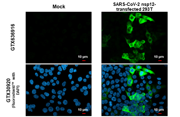 SARS-CoV-2 (COVID-19) nsp12 / RdRP antibody [HL1444] detects SARS-CoV-2 (COVID-19) nsp12 / RdRP protein at cytoplasm by immunofluorescent analysis. Sample: Mock and transfected 293T cells were fixed in 4% paraformaldehyde at RT for 15 min. Green: SARS-CoV-2 (COVID-19) nsp12 / RdRP stained by SARS-CoV-2 (COVID-19) nsp12 / RdRP antibody [HL1444] (GTX636916) diluted at 1:500. Blue: Fluoroshield with DAPI (GTX30920). Scale bar= 10μm.