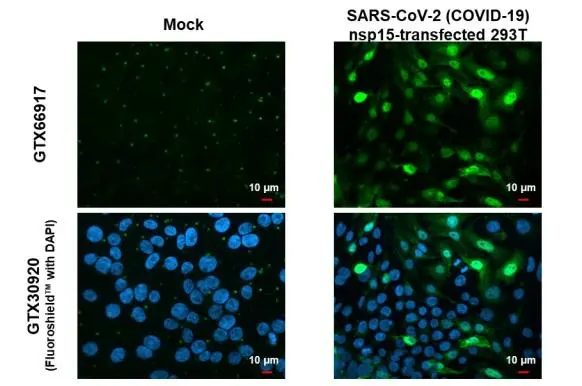 SARS-CoV-2 (COVID-19) nsp15 antibody [HL1445] detects SARS-CoV-2 (COVID-19) nsp15 protein by immunofluorescent analysis. Sample: Mock and transfected 293T cells were fixed in 4% paraformaldehyde at RT for 15 min. Green: SARS-CoV-2 (COVID-19) nsp15 stained by SARS-CoV-2 (COVID-19) nsp15 antibody [HL1445] (GTX636917) diluted at 1:1000. Blue: Fluoroshield with DAPI (GTX30920).