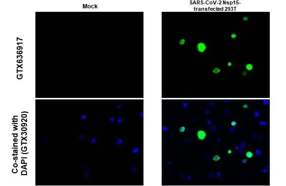 SARS-CoV-2 (COVID-19) nsp15 antibody [HL1445] detects SARS-CoV-2 (COVID-19) nsp15 protein at cytoplasm by immunohistochemical analysis. Sample: Paraffin-embedded SARS-CoV-2 (COVID-19) nsp15 transfected 293T. Green: SARS-CoV-2 (COVID-19) nsp15 stained by SARS-CoV-2 (COVID-19) nsp15 antibody [HL1445] (GTX636917) diluted at 1:1000. Blue: Fluoroshield with DAPI (GTX30920). Antigen Retrieval: Citrate buffer, pH 6.0, 15 min