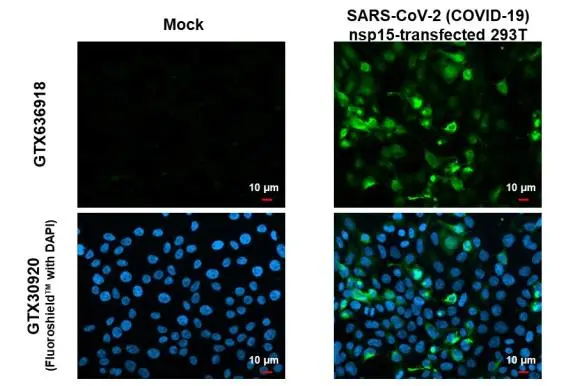 SARS-CoV-2 (COVID-19) nsp15 antibody [HL1446] detects SARS-CoV-2 (COVID-19) nsp15 protein by immunofluorescent analysis. Sample: Mock and transfected 293T cells were fixed in 4% paraformaldehyde at RT for 15 min. Green: SARS-CoV-2 (COVID-19) nsp15 stained by SARS-CoV-2 (COVID-19) nsp15 antibody [HL1446] (GTX636918) diluted at 1:1000. Blue: Fluoroshield with DAPI (GTX30920).