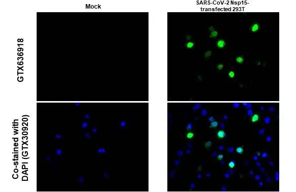 SARS-CoV-2 (COVID-19) nsp15 antibody [HL1446] detects SARS-CoV-2 (COVID-19) nsp15 protein at cytoplasm by immunohistochemical analysis. Sample: Paraffin-embedded SARS-CoV-2 (COVID-19) nsp15 transfected 293T. Green: SARS-CoV-2 (COVID-19) nsp15 stained by SARS-CoV-2 (COVID-19) nsp15 antibody [HL1446] (GTX636918) diluted at 1:1000. Blue: Fluoroshield with DAPI (GTX30920). Antigen Retrieval: Citrate buffer, pH 6.0, 15 min