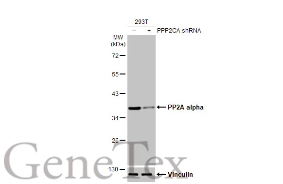 Non-transfected (–) and transfected (+) PP2A alpha shRNA-transfected 293T (30 μg) were separated by 10% SDS-PAGE, and the membrane was blotted with PP2A alpha antibody [HL1447] (GTX636919) diluted at 1:20000. The HRP-conjugated anti-rabbit IgG antibody (GTX213110-01) was used to detect the primary antibody.