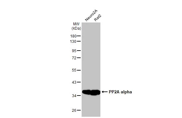 Various whole cell extracts (30 μg) were separated by 10% SDS-PAGE, and the membrane was blotted with PP2A alpha antibody [HL1447] (GTX636919) diluted at 1:2000. The HRP-conjugated anti-rabbit IgG antibody (GTX213110-01) was used to detect the primary antibody.