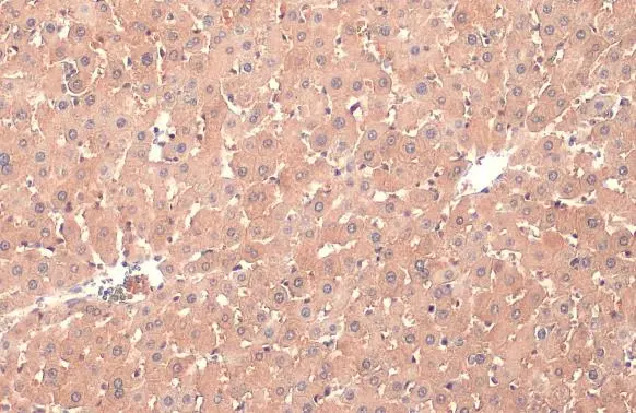 PP2A alpha antibody [HL1447] detects PP2A alpha protein at cytoplasm by immunohistochemical analysis. Sample: Paraffin-embedded rat liver. PP2A alpha stained by PP2A alpha antibody [HL1447] (GTX636919) diluted at 1:100. Antigen Retrieval: Citrate buffer, pH 6.0, 15 min