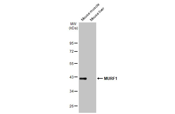 Various tissue extracts (50 μg) were separated by 10% SDS-PAGE, and the membrane was blotted with MURF1 antibody [HL1450] (GTX636922) diluted at 1:1000. The HRP-conjugated anti-rabbit IgG antibody (GTX213110-01) was used to detect the primary antibody.
