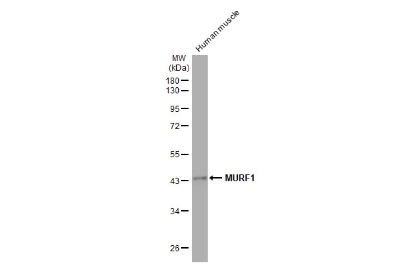Human tissue extract (10 μg) was separated by 10% SDS-PAGE, and the membrane was blotted with MURF1 antibody [HL1450] (GTX636922) diluted at 1:1000. The HRP-conjugated anti-rabbit IgG antibody (GTX213110-01) was used to detect the primary antibody.