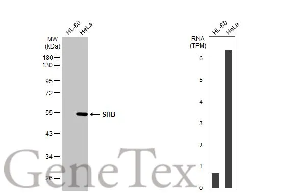 SHB antibody [HL1455]