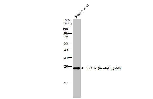 Mouse tissue extract (50 μg) was separated by 12% SDS-PAGE, and the membrane was blotted with SOD2 (Acetyl Lys68) antibody [HL1460] (GTX636934) diluted at 1:100000. The HRP-conjugated anti-rabbit IgG antibody (GTX213110-01) was used to detect the primary antibody.