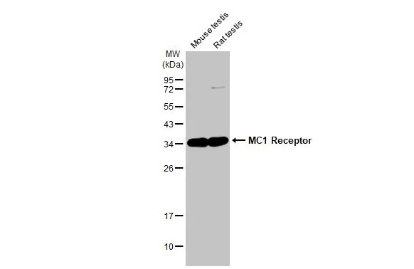 Various tissue extracts (50 μg) were separated by 12% SDS-PAGE, and the membrane was blotted with MC1 Receptor antibody [HL1470] (GTX636944) diluted at 1:1000. The HRP-conjugated anti-rabbit IgG antibody (GTX213110-01) was used to detect the primary antibody.