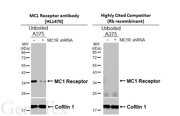 Non-transfected (–) and transfected (+) unboiled A375 whole cell extracts (30 μg) were separated by 12% SDS-PAGE, and the membranes were blotted with MC1 Receptor antibody [HL1470] (GTX636944) diluted at 1:5000 and competitor's antibody (Highly Cited Competitor) diluted at 1:5000. The HRP-conjugated anti-rabbit IgG antibody (GTX213110-01) was used to detect the primary antibody. *The competitor is not affiliated with GeneTex and does not endorse this product.