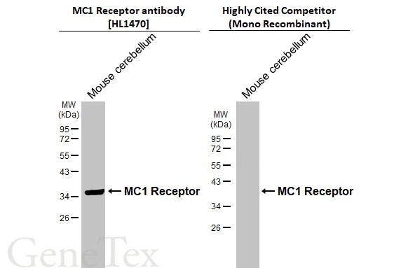 Various tissue extracts (50 μg) was separated by 12% SDS-PAGE, and the membranes were blotted with MC1 Receptor antibody [HL1470] (GTX636944) diluted at 1:1000 and competitor's antibody (Competitor) diluted at 1:1000. The HRP-conjugated anti-rabbit IgG antibody (GTX213110-01) was used to detect the primary antibody. *The competitor is not affiliated with GeneTex and does not endorse this product.