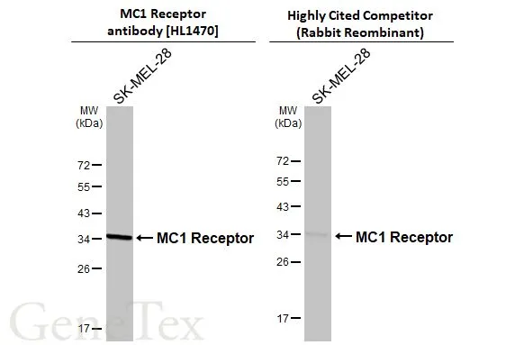 Whole cell extract (30 μg) was separated by 12% SDS-PAGE, and the membranes were blotted with MC1 Receptor antibody [HL1470] (GTX636944) diluted at 1:50000 and competitor's antibody diluted at 1:1000. The HRP-conjugated anti-rabbit IgG antibody (GTX213110-01) was used to detect the primary antibody. *The competitor is not affiliated with GeneTex and does not endorse this product.