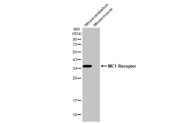Various tissue extracts (50 μg) were separated by 12% SDS-PAGE, and the membrane was blotted with MC1 Receptor antibody [HL1470] (GTX636944) diluted at 1:1000. The HRP-conjugated anti-rabbit IgG antibody (GTX213110-01) was used to detect the primary antibody.