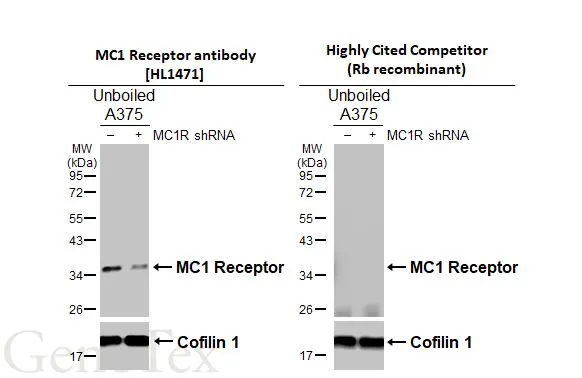 Non-transfected (–) and transfected (+) unboiled A375 whole cell extracts (30 μg) were separated by 12% SDS-PAGE, and the membranes were blotted with MC1 Receptor antibody [HL1471] (GTX636945) diluted at 1:5000 and competitor's antibody (Highly Cited Competitor) diluted at 1:5000. The HRP-conjugated anti-rabbit IgG antibody (GTX213110-01) was used to detect the primary antibody. *The competitor is not affiliated with GeneTex and does not endorse this product.