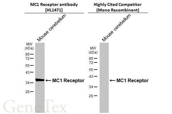 MC1 Receptor antibody [HL1471]