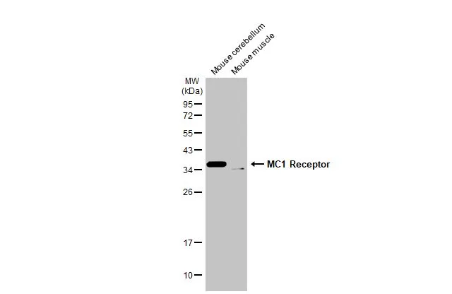 Various tissue extracts (50 μg) were separated by 12% SDS-PAGE, and the membrane was blotted with MC1 Receptor antibody [HL1471] (GTX636945) diluted at 1:1000. The HRP-conjugated anti-rabbit IgG antibody (GTX213110-01) was used to detect the primary antibody.