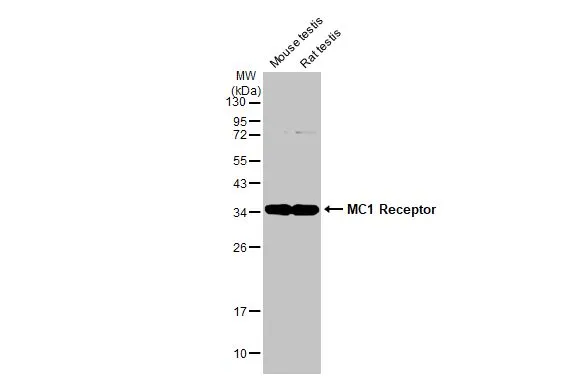 Various extracts (50 μg) were separated by 12% SDS-PAGE, and the membrane was blotted with MC1 Receptor antibody [HL1471] (GTX636945) diluted at 1:1000. The HRP-conjugated anti-rabbit IgG antibody (GTX213110-01) was used to detect the primary antibody.