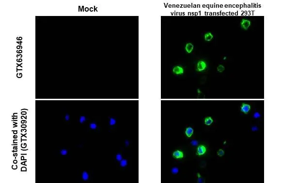 Anti-Venezuelan Equine Encephalitis Virus nsP1 antibody Anti-Venezuelan Equine Encephalitis Virus nsP1 antibody
