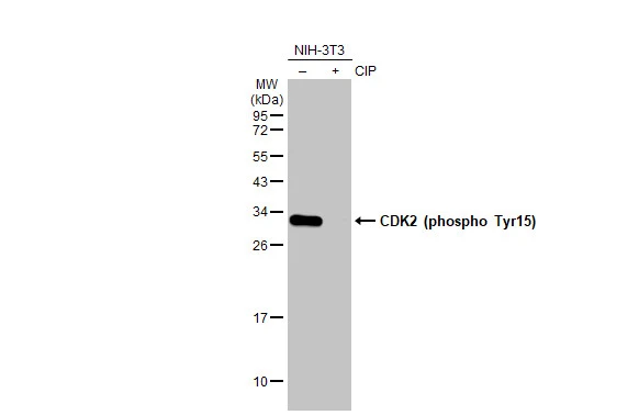 Untreated (–) and treated (+) NIH-3T3 whole cell extracts (30 μg) were separated by 12% SDS-PAGE, and the membrane was blotted with CDK2 (phospho Tyr15) antibody [HL1474] (GTX636948) diluted at 1:1000. The HRP-conjugated anti-rabbit IgG antibody (GTX213110-01) was used to detect the primary antibody.