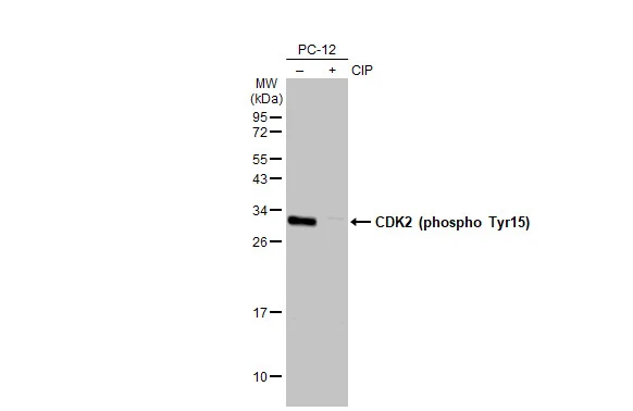 Untreated (–) and treated (+) PC-12 whole cell extracts (30 μg) were separated by 12% SDS-PAGE, and the membrane was blotted with CDK2 (phospho Tyr15) antibody [HL1474] (GTX636948) diluted at 1:1000. The HRP-conjugated anti-rabbit IgG antibody (GTX213110-01) was used to detect the primary antibody.