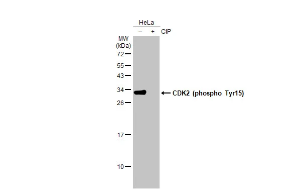 Untreated (–) and treated (+) HeLa whole cell extracts (30 μg) were separated by 12% SDS-PAGE, and the membrane was blotted with CDK2 (phospho Tyr15) antibody [HL1474] (GTX636948) diluted at 1:1000. The HRP-conjugated anti-rabbit IgG antibody (GTX213110-01) was used to detect the primary antibody.