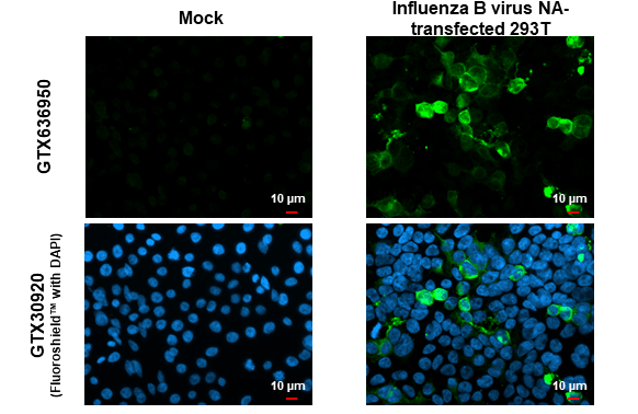 Anti-Influenza B virus Neuraminidase (NA) antibody [HL1476