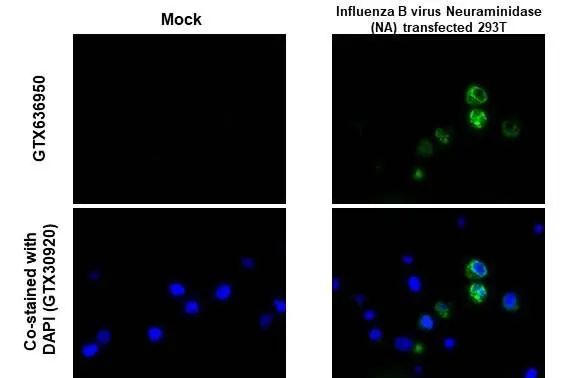 Anti-Influenza B virus Neuraminidase (NA) antibody [HL1476