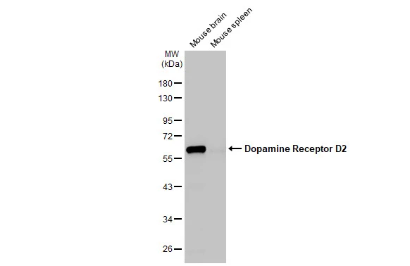 Anti-Dopamine Receptor D2 antibody [HL1478] (GTX636952