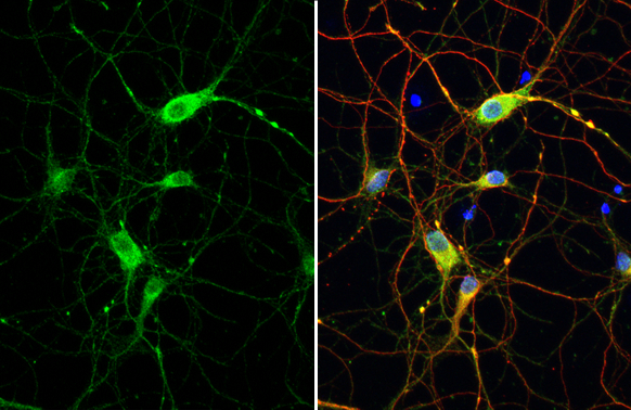 Anti-Dopamine Receptor D2 antibody [HL1478] (GTX636952