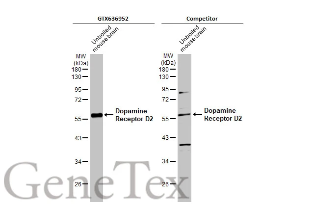 Anti-Dopamine Receptor D2 antibody [HL1478] (GTX636952