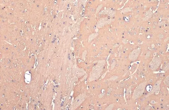 Anti-Dopamine Receptor D2 antibody [HL1478] (GTX636952