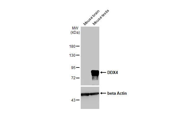 Various tissue extracts (50 μg) were separated by 7.5% SDS-PAGE, and the membrane was blotted with DDX4 antibody [HL1487] (GTX636961) diluted at 1:10000. The HRP-conjugated anti-rabbit IgG antibody (GTX213110-01) was used to detect the primary antibody.