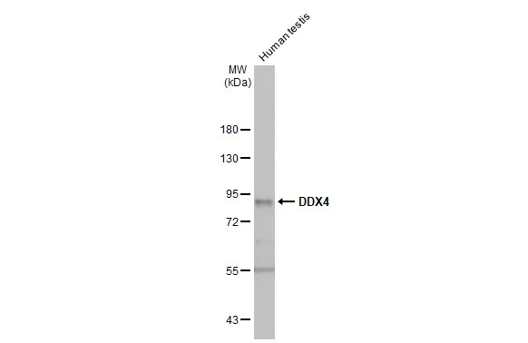 Human tissue extract (50 μg) was separated by 7.5% SDS-PAGE, and the membrane was blotted with DDX4 antibody [HL1487] (GTX636961) diluted at 1:10000. The HRP-conjugated anti-rabbit IgG antibody (GTX213110-01) was used to detect the primary antibody.