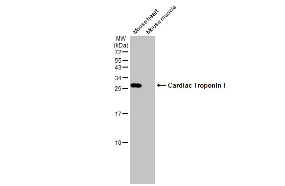 Various tissue extracts (50 μg) were separated by 15% SDS-PAGE, and the membrane was blotted with Cardiac Troponin I antibody [HL1489] (GTX636963) diluted at 1:10000. The HRP-conjugated anti-rabbit IgG antibody (GTX213110-01) was used to detect the primary antibody.