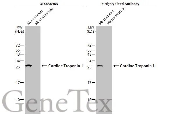 Various tissue extracts (50 μg) were separated by 15% SDS-PAGE, and the membranes were blotted with Cardiac Troponin I antibody [HL1489] (GTX636963) diluted at 1:10000 and competitor's antibody (# Highly Cited Antibody) diluted at 1:3000. The HRP-conjugated anti-rabbit IgG antibody (GTX213110-01) was used to detect the primary antibody. *The competitor is not affiliated with GeneTex and does not endorse this product.