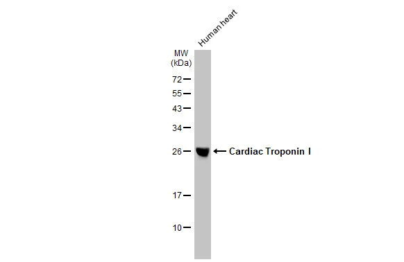 Human tissue extract (50 μg) was separated by 12% SDS-PAGE, and the membrane was blotted with Cardiac Troponin I antibody [HL1489] (GTX636963) diluted at 1:10000. The HRP-conjugated anti-rabbit IgG antibody (GTX213110-01) was used to detect the primary antibody.