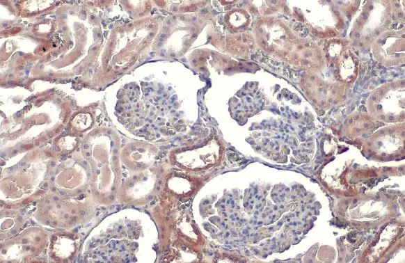 TOMM20 antibody [HL1493] detects TOMM20 protein at cytoplasm by immunohistochemical analysis. Sample: Paraffin-embedded rat kidney. TOMM20 stained by TOMM20 antibody [HL1493] (GTX636967) diluted at 1:100. Antigen Retrieval: Citrate buffer, pH 6.0, 15 min