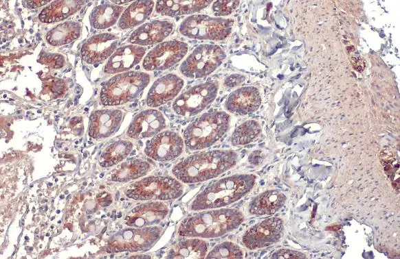 TOMM20 antibody [HL1494] detects TOMM20 protein at mitochondria by immunohistochemical analysis. Sample: Paraffin-embedded rat duodenum. TOMM20 stained by TOMM20 antibody [HL1494] (GTX636968) diluted at 1:100. Antigen Retrieval: Citrate buffer, pH 6.0, 15 min