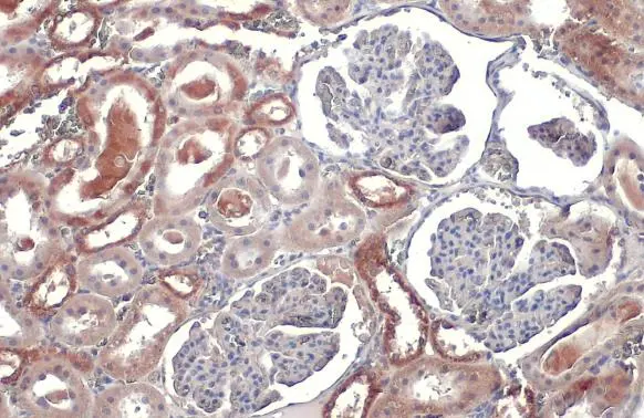 TOMM20 antibody [HL1494] detects TOMM20 protein at cytoplasm by immunohistochemical analysis. Sample: Paraffin-embedded rat kidney. TOMM20 stained by TOMM20 antibody [HL1494] (GTX636968) diluted at 1:100. Antigen Retrieval: Citrate buffer, pH 6.0, 15 min