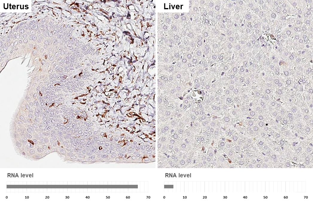 Anti-Vimentin antibody [HL1506] (GTX636980) | GeneTex