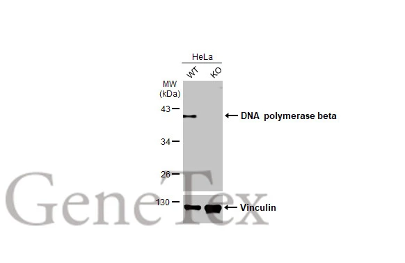 Wild-type (WT) and POLB knockout (KO) HeLa cell extracts (30 μg) were separated by 10% SDS-PAGE, and the membrane was blotted with DNA polymerase beta antibody [HL1512] (GTX636986) diluted at 1:1000. The HRP-conjugated anti-rabbit IgG antibody (GTX213110-01) was used to detect the primary antibody, and the signal was developed with Trident ECL plus-Enhanced.