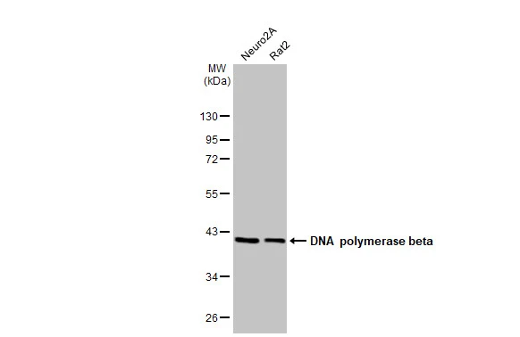 Various whole cell extracts (30 μg) were separated by 10% SDS-PAGE, and the membrane was blotted with DNA polymerase beta antibody [HL1512] (GTX636986) diluted at 1:1000. The HRP-conjugated anti-rabbit IgG antibody (GTX213110-01) was used to detect the primary antibody.