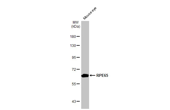 Mouse tissue extract (50 μg) was separated by 7.5% SDS-PAGE, and the membrane was blotted with RPE65 antibody [HL1519] (GTX636993) diluted at 1:1000. The HRP-conjugated anti-rabbit IgG antibody (GTX213110-01) was used to detect the primary antibody.