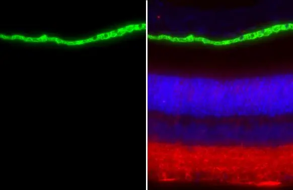 RPE65 antibody [HL1519] detects RPE65 protein at cell membrane and cytoplasm by immunohistochemical analysis. Sample: Paraffin-embedded mouse eye. Green: RPE65 stained by RPE65 antibody [HL1519] (GTX636993) diluted at 1:200. Red: beta Tubulin 3/ Tuj1, a neural marker, stained by beta Tubulin 3/ Tuj1 antibody [GT11710] (GTX631836) diluted at 1:500. Blue: Fluoroshield with DAPI (GTX30920). Antigen Retrieval: Citrate buffer, pH 6.0, 15 min