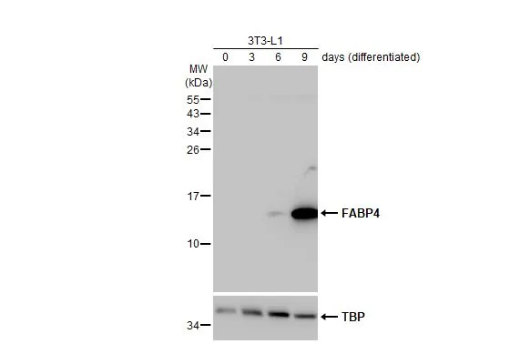 Various whole cell extracts (30 μg) were separated by 15% SDS-PAGE, and the membrane was blotted with FABP4 antibody [HL1520] (GTX636994) diluted at 1:5000. The HRP-conjugated anti-rabbit IgG antibody (GTX213110-01) was used to detect the primary antibody.