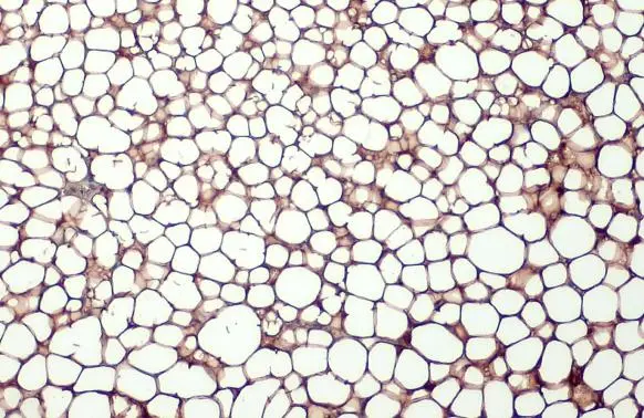 FABP4 antibody [HL1520] detects FABP4 protein at cytoplasm by immunohistochemical analysis. Sample: Paraffin-embedded mouse white adipocyte. FABP4 stained by FABP4 antibody [HL1520] (GTX636994) diluted at 1:100. Antigen Retrieval: Citrate buffer, pH 6.0, 15 min