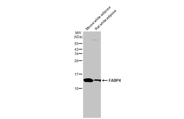 Various tissue extracts (50 μg) were separated by 15% SDS-PAGE, and the membrane was blotted with FABP4 antibody [HL1520] (GTX636994) diluted at 1:5000. The HRP-conjugated anti-rabbit IgG antibody (GTX213110-01) was used to detect the primary antibody.